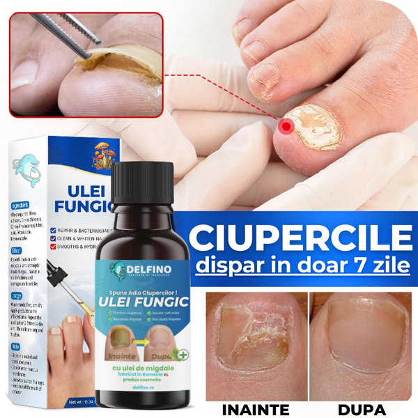 Ulei fungic pentru ciuperca unghiilor