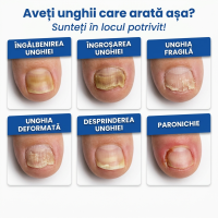 Ulei Fungic Delfino — pentru unghii cu modificări de aspect — imaginea 6