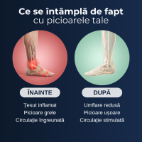 Șosete cu Fir de Cupru Delfino — pentru picioare obosite — imaginea 8