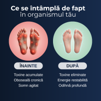 Plasturi Delfino — 20 bucăți pentru aplicație nocturnă — imaginea 8