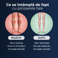 Dispozitiv Bioterapie Delfino — NMES cu fibre de cupru, certificat CE Clasa II — imaginea 8