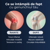 Gonartron Delfino — masaj pentru genunchi cu căldură și vibrații — imaginea 8