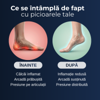 Tălpi Ortopedice Delfino — confort discret în orice pantof — imaginea 8