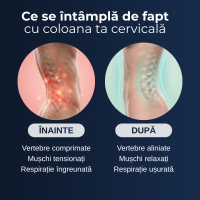 Centură Lombară Delfino — susținere zilnică pentru zona lombară — imaginea 8