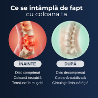 Brâu Lombar Delfino — susținere fermă pentru zona joasă a spatelui — imaginea 8